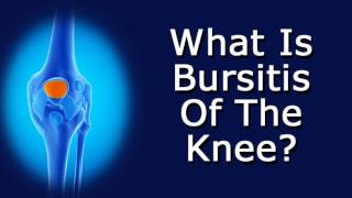 What Is Bursitis Of The Knee [upl. by Suoivatram183]