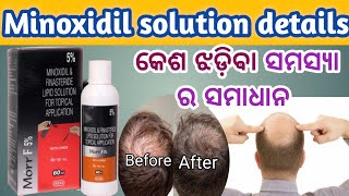 I Tried Morr F 5 Minoxidil  କେଶ ଝଡ଼ିବା ବନ୍ଦ କରିଥାଏ  The Best Hair Loss Treatment [upl. by Geoffry457]