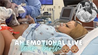 THE LIVE BIRTH OF OUR SECOND SET OF TWINS  Real Raw amp Emotional Doctor Turns Breech Baby in Womb [upl. by Elgna446]