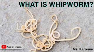 What is Whipworm  Biotechnology  General Medicine [upl. by Aihsinyt361]