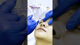 💉Botox for antiaging treatment [upl. by Lleznod719]