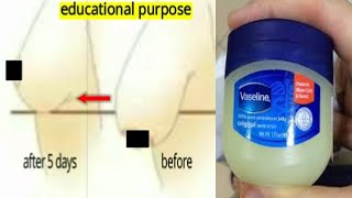 TIGHTEN SAGGING BREAST IN 5 DAYS USING VASELINE AT NIGHT result in demo [upl. by Aihpos378]