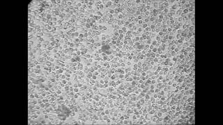 Exflagellation of Plasmodium berghei in vitro [upl. by Aineg]