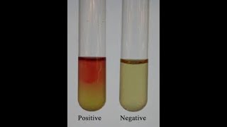 Voges Proskauer VP Test Principle Procedure Results and Interpretation شرح بالعربى [upl. by Elok]