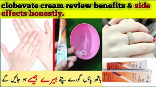 clobevate hand ampfeet whitening cream 7 days resultsclobevate cream review benefits amp side effects [upl. by Erlandson]