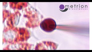 Demonstration of EndoLysosomal Patch Clamp Technique [upl. by Jermaine]