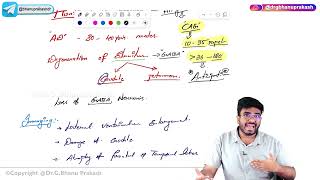 6 Huntingtons Disease Pathology 🧠 USMLE Step 1 [upl. by Aleda]