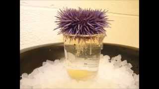 How to get sperm and eggs from a sea urchin [upl. by Oflunra]