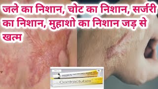 contractubex gel का use चोट निशान जले का निशान ओर किसी भी प्रकार के निशान को जड़ से खत्म [upl. by Chem]