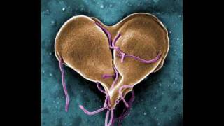 Infectious Disease InfoVid  Giardia [upl. by Yeleen]