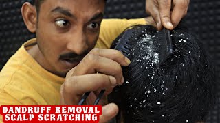 Scalp Scratching with Comb  Dandruff Scratching amp Removal from Scalp  Neck Cracking  ASMR [upl. by Nylatsirhc]