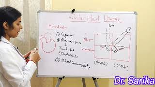 10 VALVULAR HEART DISEASE [upl. by Ayisan269]