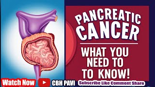 Pancreatic Cancer Symptoms Causes and Latest Treatment Options Revealed Today [upl. by Jehanna]