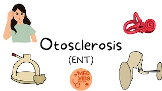 Otosclerosis  ENT lecture  Otorhinolaryngology  Med Vids Made Simple [upl. by Otilia]