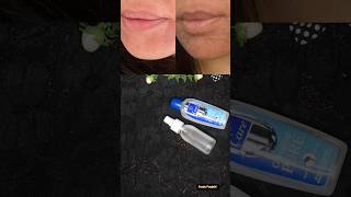 DIY spray for Rough and dry skin skincaretips shortsviral youtubeshorts [upl. by Atileda]