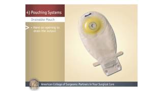 ColostomyIleostomy Pouching Systems [upl. by Euell]