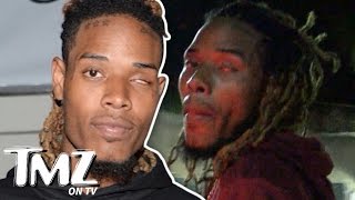 Fetty Wap Eye Don’t Need No Stinkin’ Eye  TMZ TV [upl. by Schaeffer]