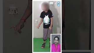 Cerebral palsyaffected girl with crouch gait started walking independently at Trishla CPchild [upl. by Hedveh49]