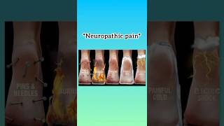 NEUROPATHIC PAIN health [upl. by Whalen319]