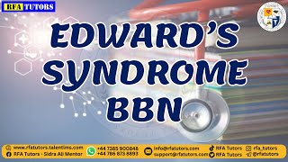 Edwards Syndrome BBN [upl. by Llehsal]