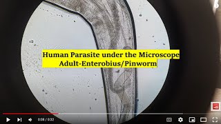 Adult Pinworm under the Microscope [upl. by Fionnula296]