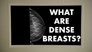 What are Dense Breasts [upl. by Elbys]