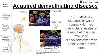 Acquired demyelinating diseases [upl. by Anear]