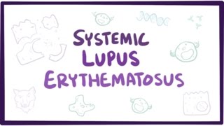 Systemic lupus erythematosus SLE  causes symptoms diagnosis amp pathology [upl. by Ylrac539]