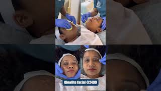 Dermatrix Glowlite Facial for Glowing and Brighter Skin  Best Skin Care Clinic [upl. by Neilson]