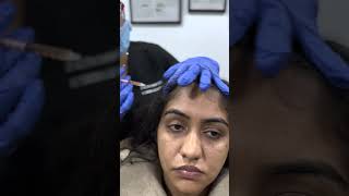 Female Hair PRP Treatment at Cara Clinic  Hair PRP [upl. by Aerdnaed]