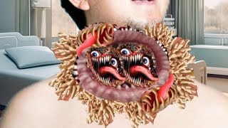 Throat insect and fungus removal asmr 2D animation best relaxing treatment and good cleaning❤️❤️❤️ [upl. by Slyke]