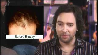 Musician Jerry Lopez Bosley Hair Transplant Testimonial [upl. by Ennavoj]