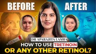 How to use TRETINOIN Cream ❌🚀 RETINOIDS Explained in detail By DERMATOLOGIST✅  Dr Aparajita Lamba [upl. by Akkeber]