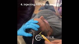 The miracle of Hair PRP [upl. by Anna]