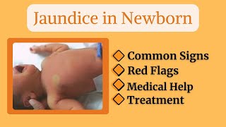 “Why Do Newborns Turn Yellow Understanding Jaundice in Babies” baby newborn newparentsguide [upl. by Annayhs999]