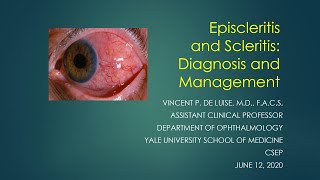 Scleritis and Episcleritis Vincent de Luise MD [upl. by Riker183]