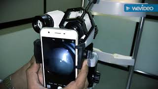 Smartphone Slitlamp Microscope Adapter [upl. by Enilasor]