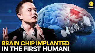 Elon Musks Neuralink implants brain chip in human for the first time  WION Originals [upl. by Margaretha]