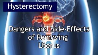 Hysterectomy Dangers amp Side Effects  Antai Hospital [upl. by Apps]