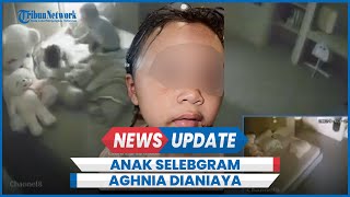 Detikdetik Suster Diduga Aniaya Anak Selebgram Emy Aghnia Terekam CCTV [upl. by Oelc]