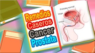 5 Remedios Caseros Para El Cancer De Prostata [upl. by Sauer]