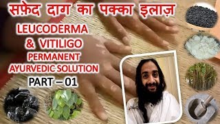 सफ़ेद दाग का पक्का इलाज़1 LEUCODERMA AND VITILIGO PERMANENT AYURVEDIC SOLUTION  PART  01 [upl. by Thomasina]