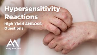 Mastering Hypersensitivity Reactions HighYield AMBOSS Questions Explained  Acing Medicine [upl. by Ydnolem]