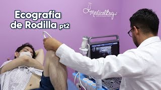 ¿Cómo hacer una ecografía MSK de rodilla [upl. by Nailij]