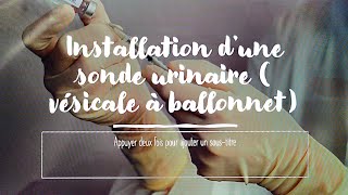 comment installer une sonde urinaire vésicale à ballonnet [upl. by Orrocos75]