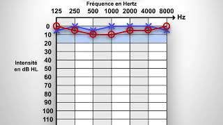 Audiogramme [upl. by Dasteel]