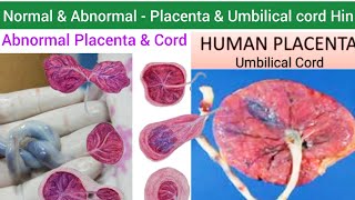 Human Placenta  Structure Function amp Abnormalities of Placenta amp Umbilical cord  Umbilical Cord [upl. by Baun]