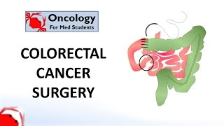 Colorectal Cancer Surgery principles and types [upl. by Dedie]