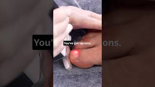 Absolute Best Toenail Fungus Cure [upl. by Raama]