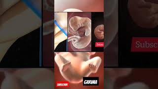 Fetal development momtobe pregnancystages viralvideo babybumplove [upl. by Iasi620]